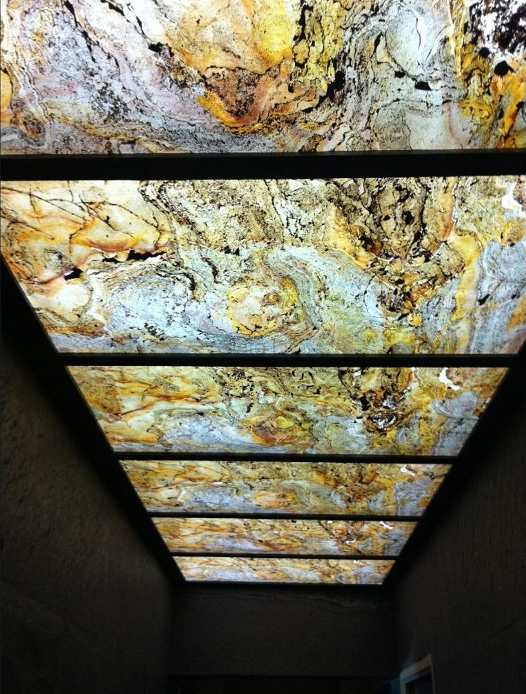 Translucent Veneer 